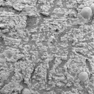 Croûte mamelonnée avec sphérules de l'affleurement Stone Mountain de Meridiani Planum