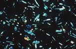 Périphérie de lave basaltique en coussin au microscope, lumière polarisée analysée (LPA)