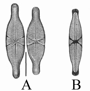 Microphotographies de Capartogramma crucicula