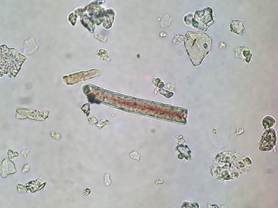 Phytolithes allongés vus au microscope