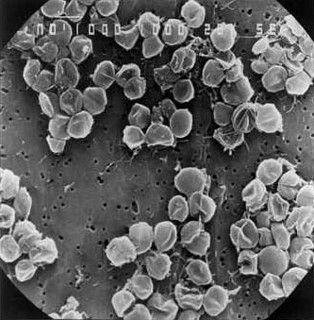 Un exemple d'archée hyperthermophile (et aussi piézophile) : Pyrococcus abyssi vu en microscopie électronique à balayage (0,8 à 2 μm)
