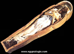 Un exemple de corps momifié : Ramsès II